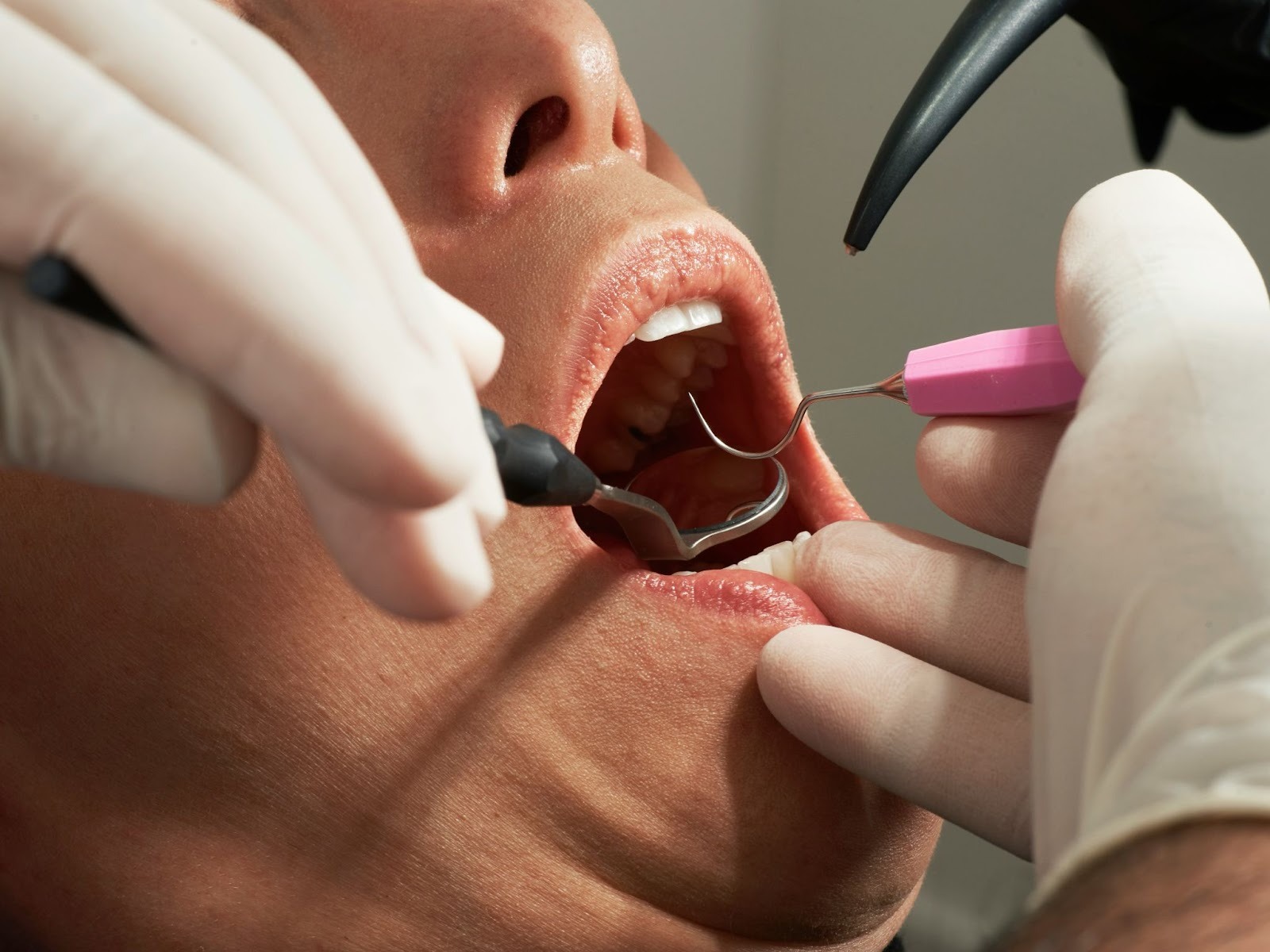 The Long Term Impact of Poor Dental Treatment